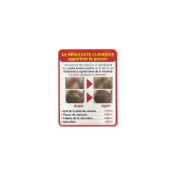 Claude Bell Hair Force One Lotion Tonifiante Anti-Chute -Taurus Alpatec Boutique hair force one lotion tonifiante anti chute 9680988 25079140 1140x1140